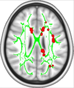 Kan sensitisatie overgaan 2